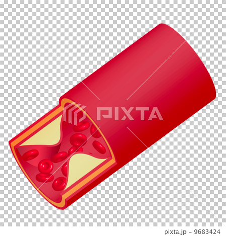 血管 血管 9683424