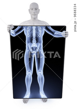 statue xray 9688334