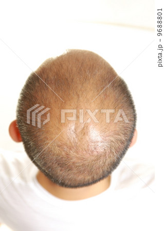 薄毛の男性　 9688801