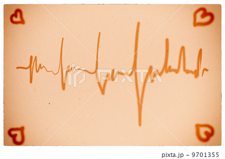 Electrocardiogram orange background 9701355