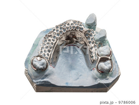 Dental Prothetic laboratory,partial denture molds 9786006