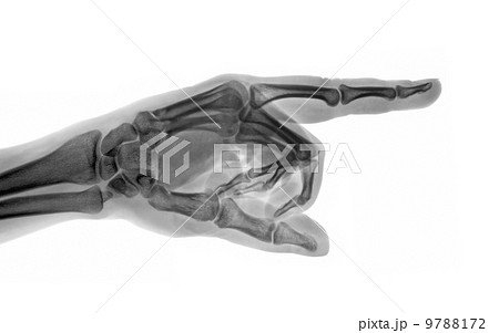 Roentgenogram 9788172