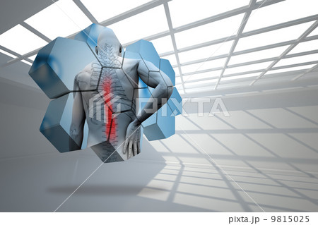 Composite image of back injury diagram on abstract screen Composite image of back injury diagram on abstract screen 9815025