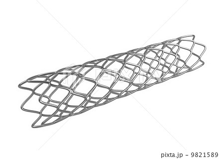 Stent 9821589