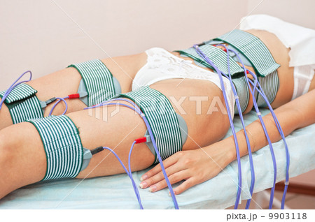 procedure procedure 9903118
