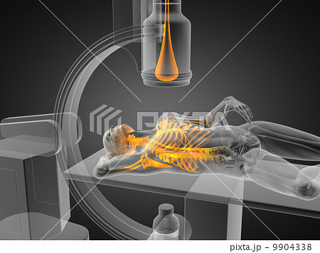 x-ray examination made in 3D 9904338