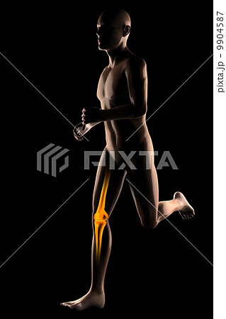 running man radiography 9904587