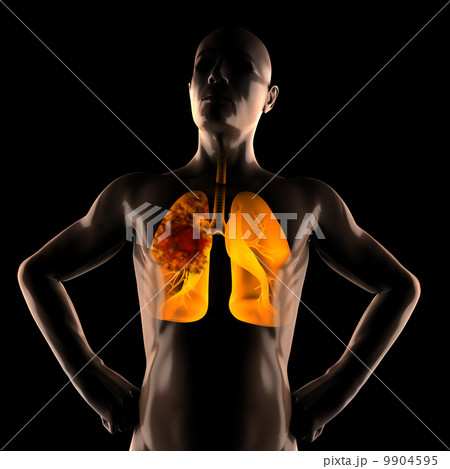 human chest radiography scan 9904595