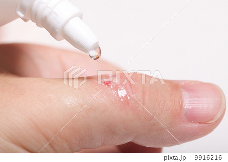 disinfect the scratch alcohol cuts hand health 9916216