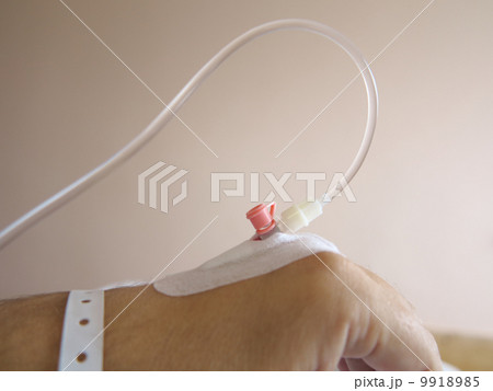 Patient's hand in the hospital with an IV Patient's hand in the hospital with an IV 9918985