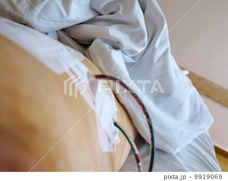 patient in hospital after surgery with drainage patient in hospital after surgery with drainage 9919069