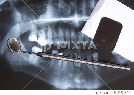 X-ray scan of humans teeth 9919070