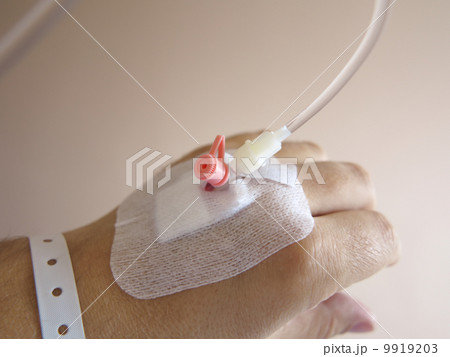 Patient's hand in the hospital with an IV 9919203