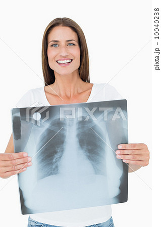 Portrait of a smiling young woman holding lung x-ray 10040238