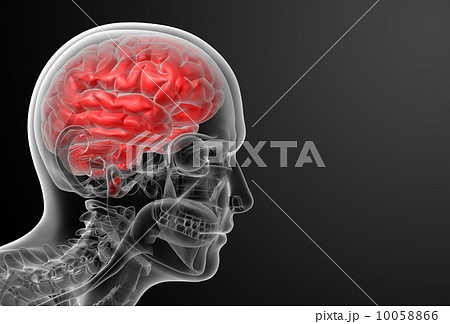 Human brain X ray - side view 10058866