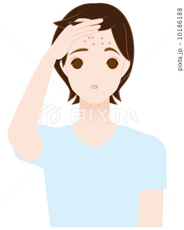 おでこニキビに悩やむ男の子 10186188