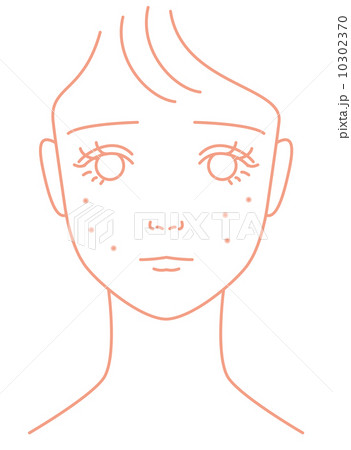 頬ニキビに悩やむ女の子  10302370