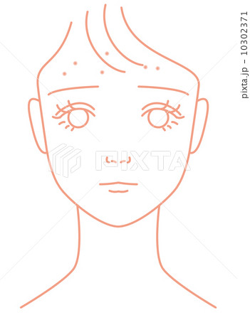 おでこニキビに悩やむ女の子 おでこニキビに悩やむ女の子 10302371