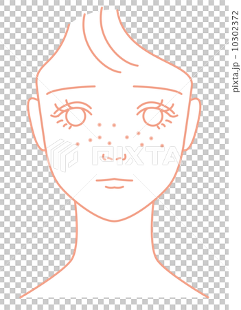 そばかすに悩やむ女の子  10302372