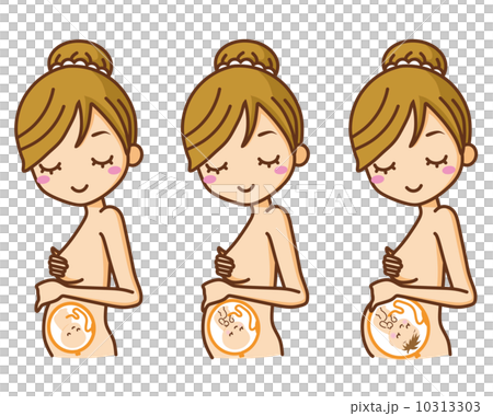 妊婦　胎児 10313303