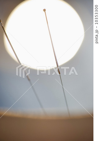 Acupuncture needles 10353300