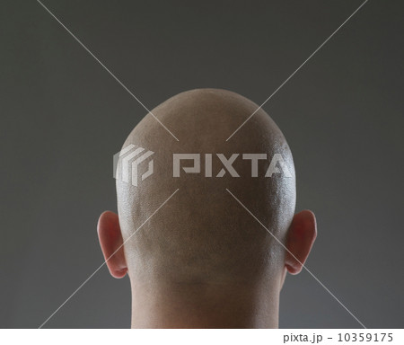 Back view of man with shaved head 10359175