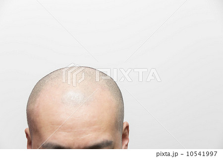育毛イメージ 育毛イメージ 10541997