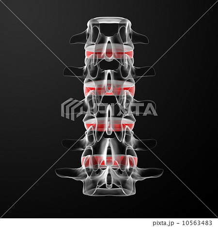 intervertebral discs 10563483