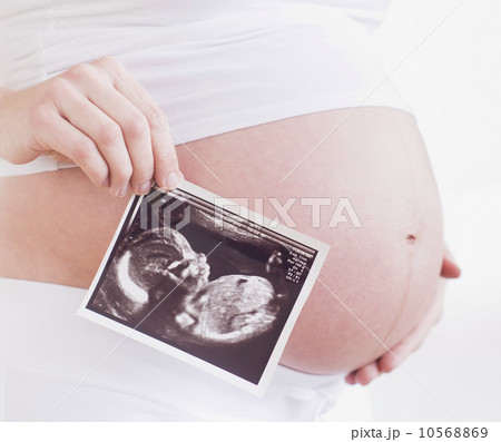 Pregnant woman with ultrasonography scan Pregnant woman with ultrasonography scan 10568869