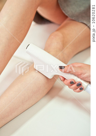 laser epilation laser epilation 10620281