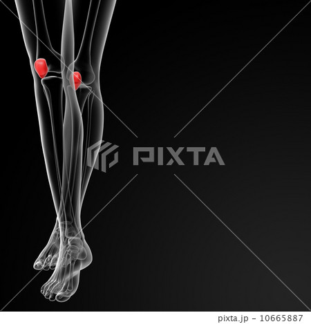 patella bone 10665887