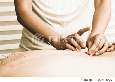 Nurse with acupuncture patient Nurse with acupuncture patient 10741655
