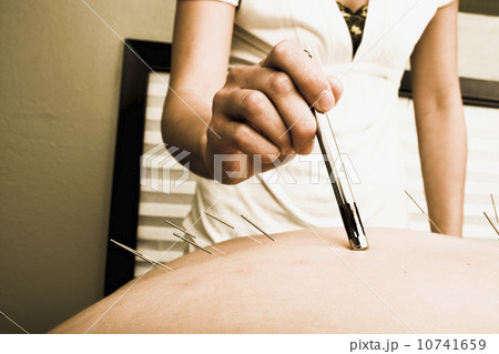 Nurse with acupuncture patient Nurse with acupuncture patient 10741659