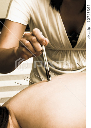Nurse with acupuncture patient 10743365