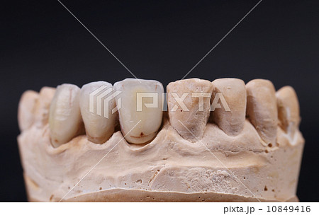 Close up of dental prothetic jaw. 10849416