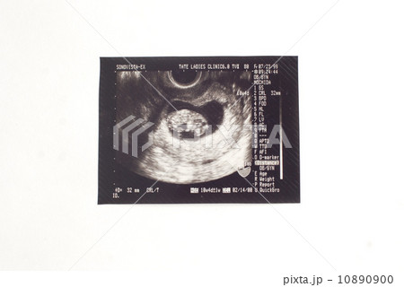 胎児 10890900