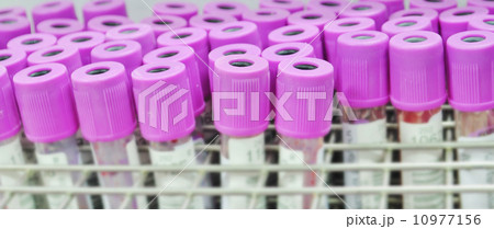 a view blood tubes in detail 10977156