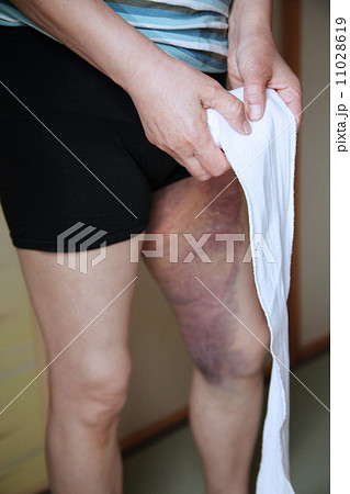 中高年の怪我 中高年の怪我 11028619