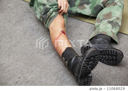 Gunshot wound Gunshot wound 11068029