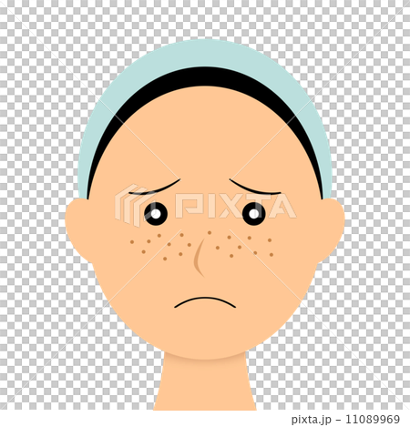 Women suffering from freckles 11089969