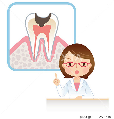歯医者 虫歯予防のイラスト素材