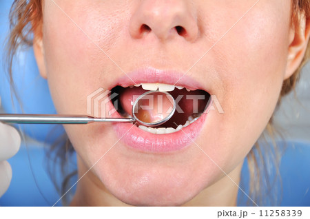 dental checkup dental checkup 11258339