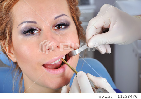 removes the tooth 11258476