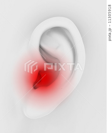 loss of hearing loss of hearing 11305918