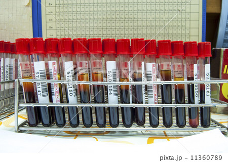 Red Medical test-tube with blood samples Red Medical test-tube with blood samples 11360789