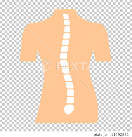 背骨のゆがみ 背骨のゆがみ 11392281