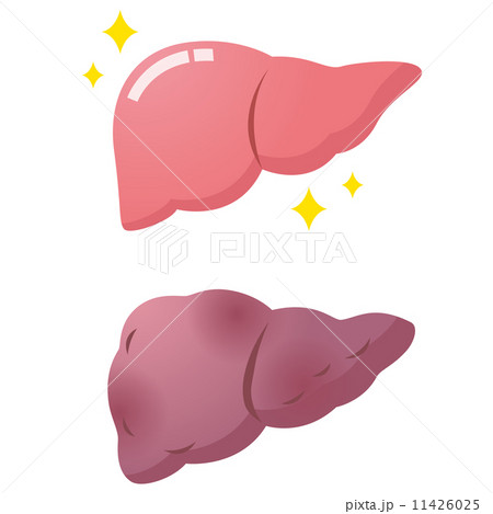 医療　健康　肝臓 11426025