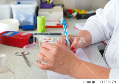 Blood type testing. Blood type testing. 11430179