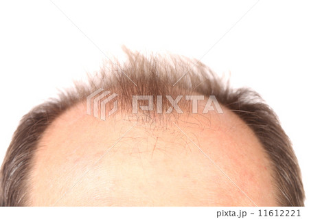 Bald men. 11612221