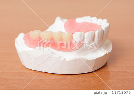 acrylic denture (False teeth) 11715079